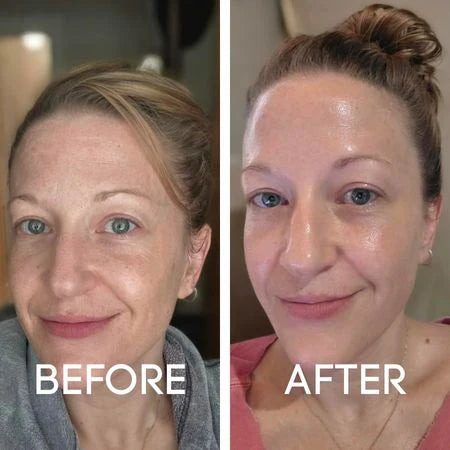 Intensive Lifting Silk Peptide