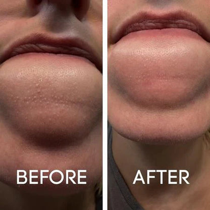 Intensive Lifting Silk Peptide